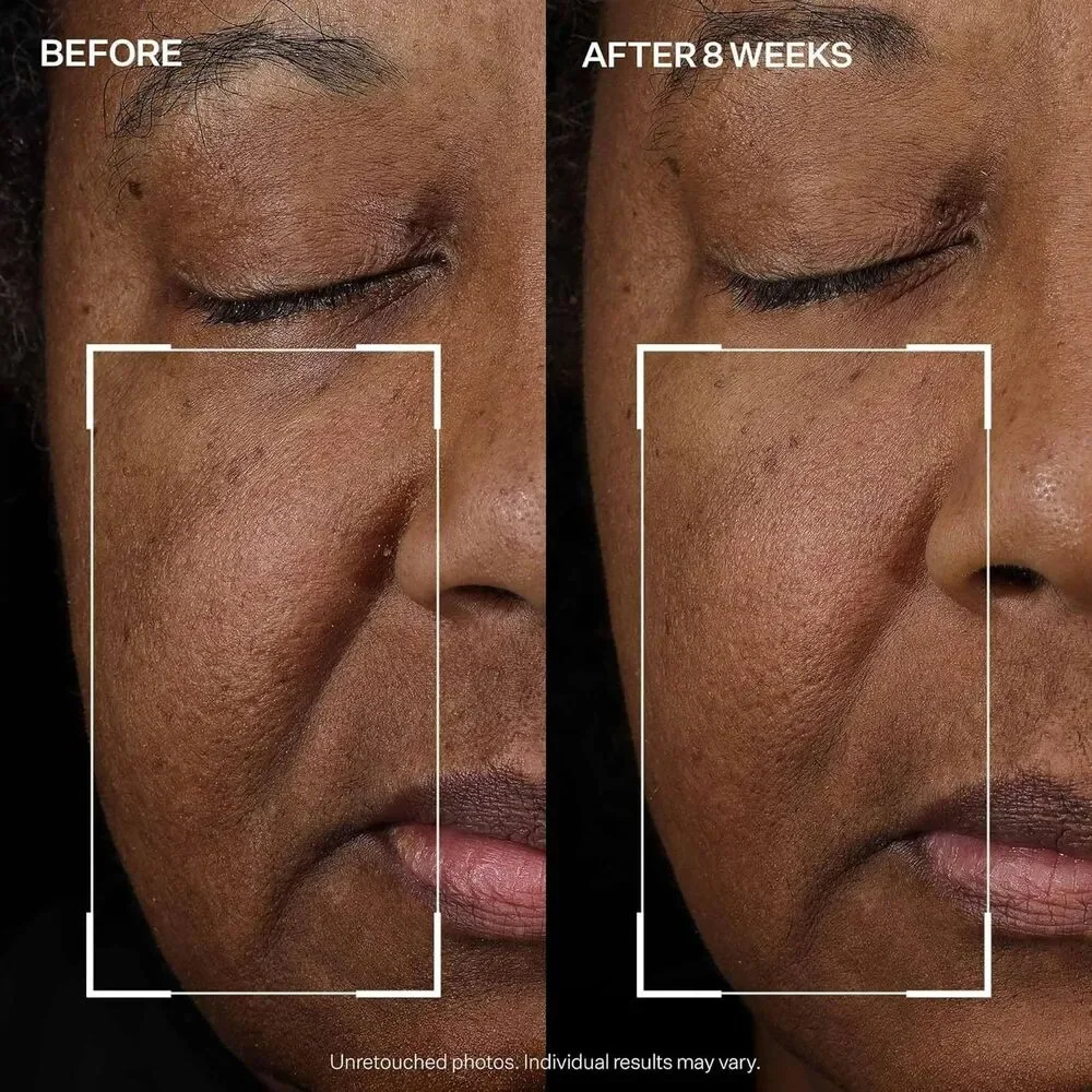 StriVectin Tighten & Lift Peptight Face Lift Serum Tightening & Brightening 1oz